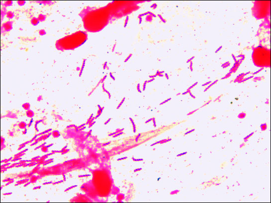 Helicobacter Pylori Gram Stain